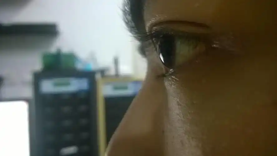 本人今年21岁近视450度眼球好像有点往外凸出?