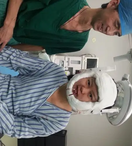 局部麻醉磨骨 下颌角 削骨有多可怕(图解手术过程,胆小勿入)