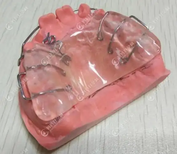 科普36岁儿童地包天牙齿戴推簧矫正器的原理和适应症