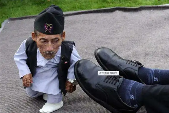 世界上最小的人排行榜前五名 因为疾病而变得矮小 - 我要新鲜事