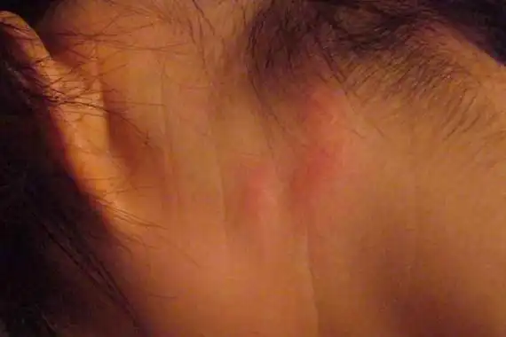 猫身上有虱子怎么办猫虱子怎么去除