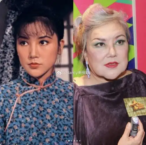 韩国变美##面部填充##变美失败##邵音音