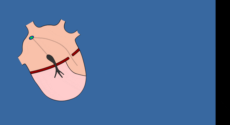 "运动员的心跳"代表心脏健康?