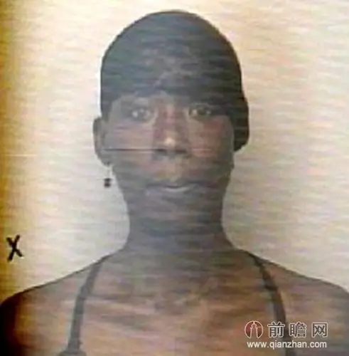 男子嫌工作累切除自己睾丸卖掉 切蛋过程直播