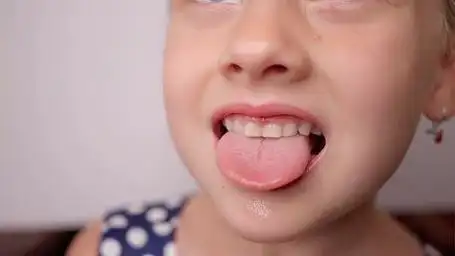 孩子舌苔白,有口气是为什么呢和肠胃有关系吗