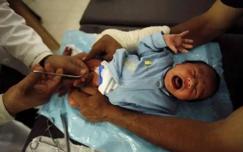 香港包皮过长医院_香港治疗包皮过长哪家医院好_香港