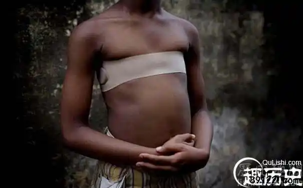 可怕陋习竟用热石头烫少女的胸部实行割礼