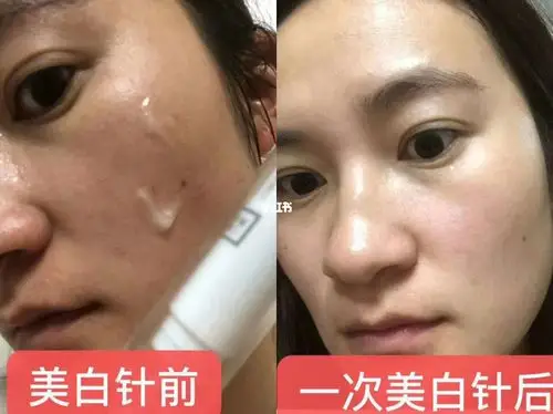 美白_美白_滤镜_传明酸_美白针_烟酰胺_玉肌怎么样_怎样美白_美妆