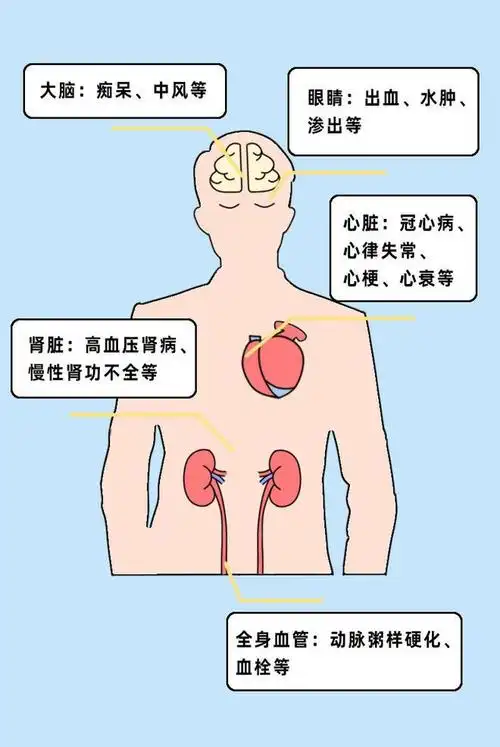 你会是"高血压候选人"吗?快来自测,一分钟测出患病风险