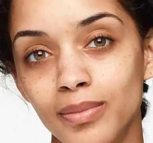 夏日美白大集合:暗沉发黄,色斑的改善方法