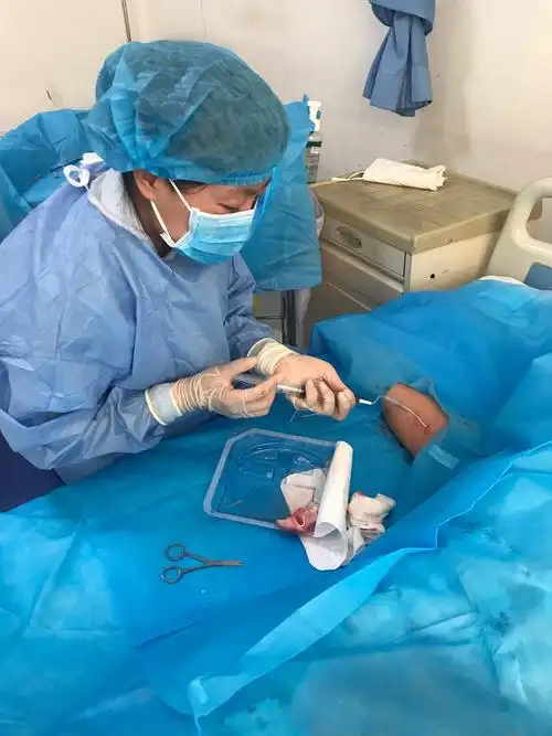 包医二附院picc小组为一名多次置管的血液病患者再次置管成功