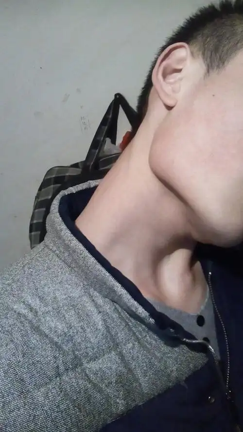 人生怎么又那么多不如意,我这下颌角是不是太大,显得下巴很方,打算去