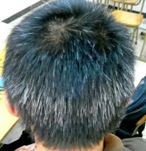 这种情况下人真的会一夜白头