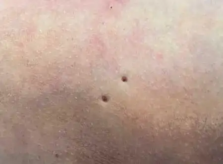 是尸斑,还是瘀伤:——宿迁男子猝死的身后事