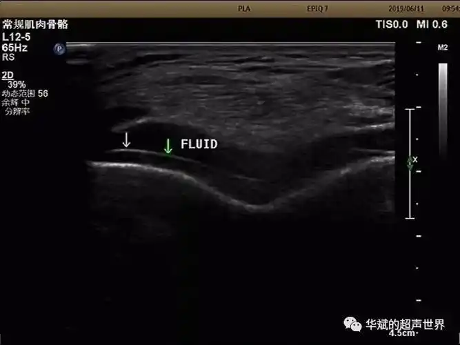 图片分享真假双轨征