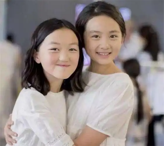 李嫣的兔唇是遗传吗 李嫣的兔唇前后照片对比令人心疼