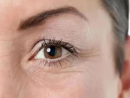 眼部干纹和细纹竟然不一样!干纹和细纹保养这样做