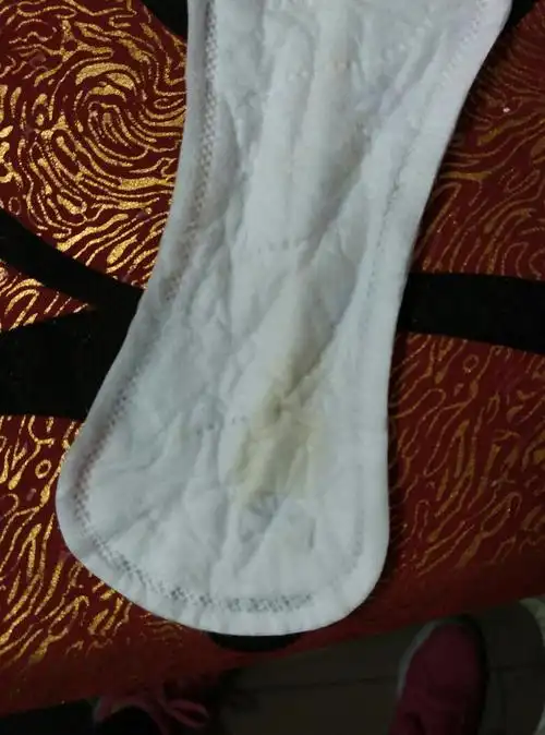 > 帖子详情20楼 123456789………:黄色的,我以为是漏尿,总是有一小块