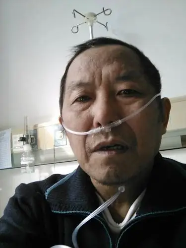 为晚期肺癌的爸爸筹钱做多次放疗