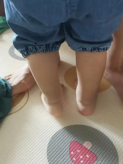 宝宝走路内八字