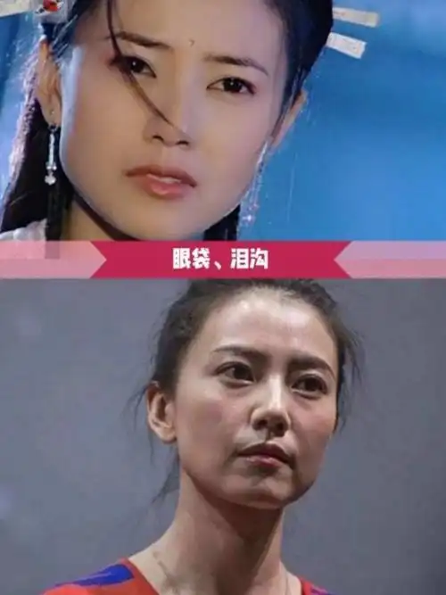 明星衰老照对比,看看迪丽热巴,赵雅芝,袁泉,高圆圆_肌肤