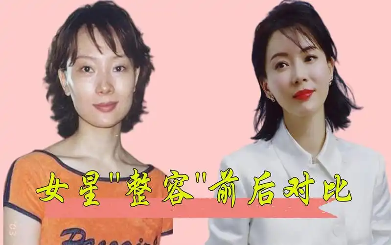 女星整容前后对比,陈数秒杀18岁少女,张檬取出假体颜值重回巅峰