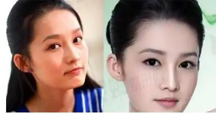 我们从《新红楼梦》中李沁的照片和李沁现在的照片做一个对比,我们会