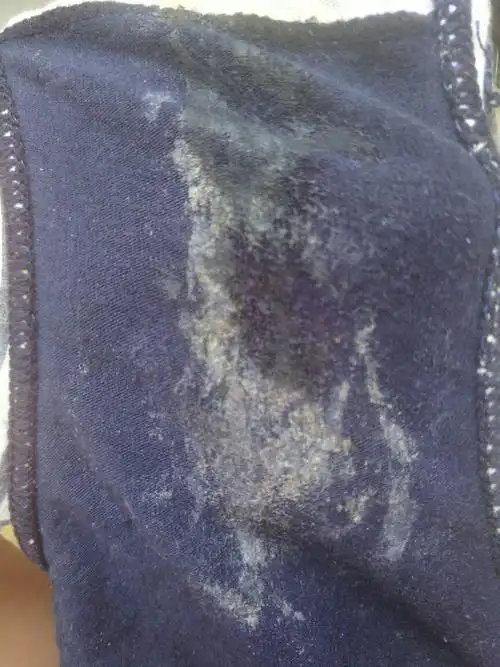 这样的白带算正常吗?