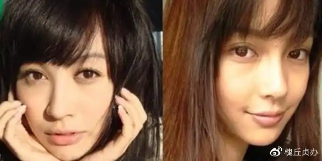 但有人对比了李菲儿整容前后的照片,发现变化的地方不少,比如脸型