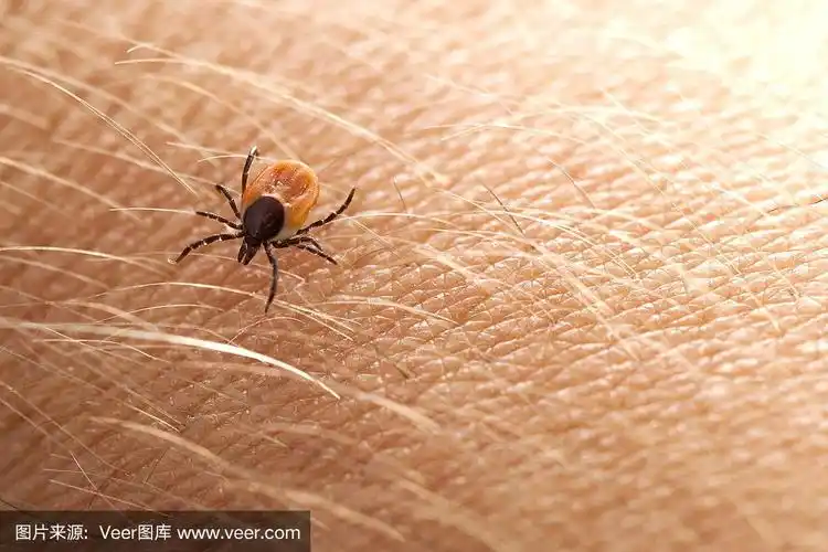 人皮肤上的蜱虫
