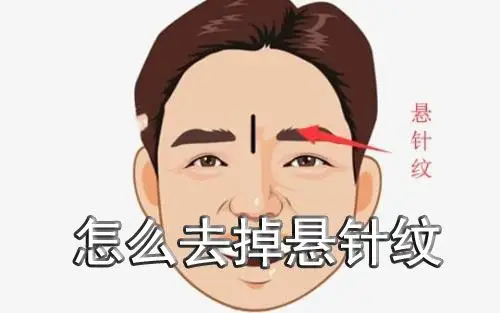 怎么去掉悬针纹悬针纹去除方法