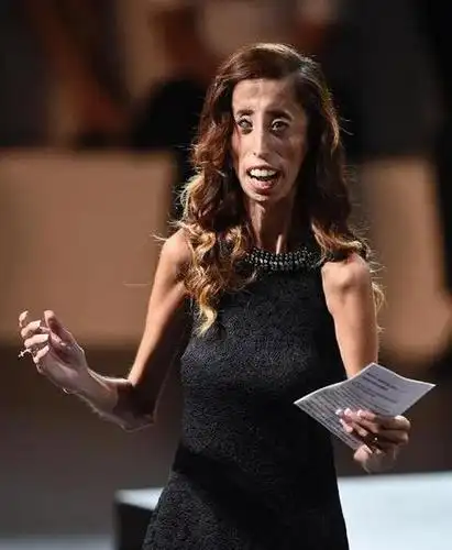 世界最丑女人拍励志纪录片