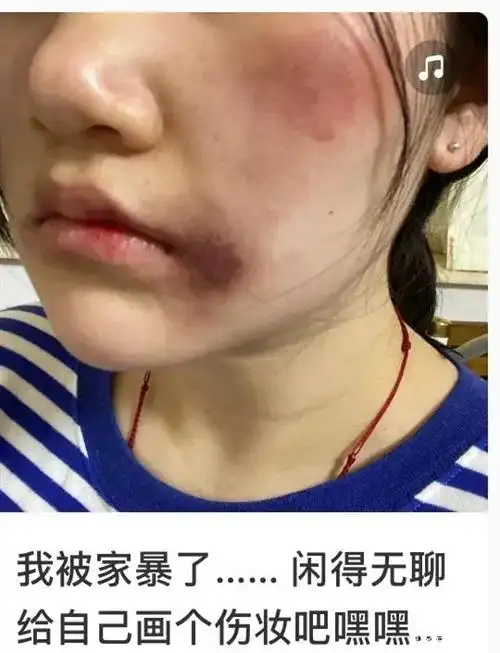 被家暴妻子跳楼逃生,拿这个开玩笑的人,是没有心吗?