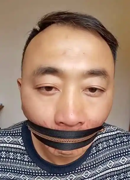 缝嘴的视频火了,就是吃喝不方便,这次装上拉链,能吃能喝,还不能乱说话