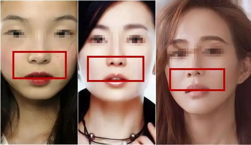 人中如果有曲线还是水滴形的那当然是深一点比较好会显得上唇上翘洋气