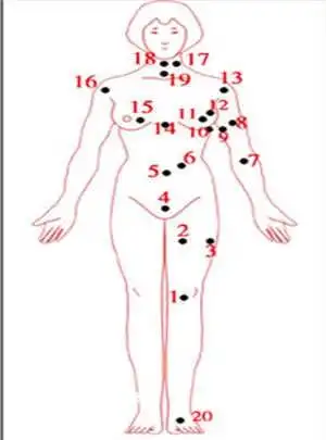 常识大全 女人全身痣相图解  长痣处(1):   在膝盖上长痣的女人:天性