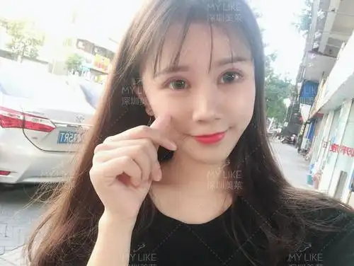 眼睑下至术是什么?与开外眼角有什么区别?_手术