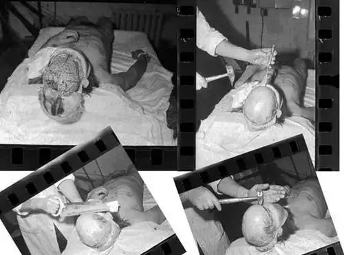 前苏联劳改营遍布白骨 科学家曾摘取活人大脑(图)