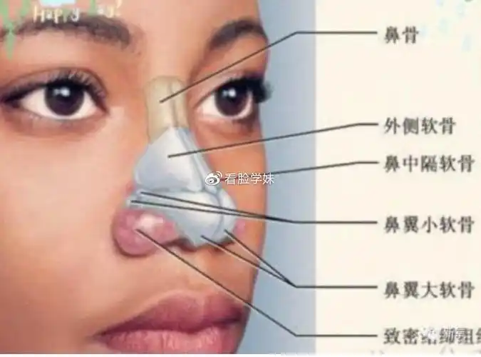 发育过度造成,表现为鼻背过宽,鼻背低平,有时鼻梁从侧面看上去并不低
