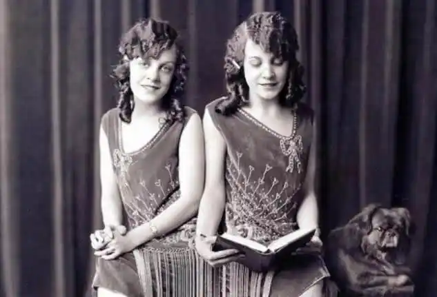 最美丽连体双胞胎世界最知名的连体双胞胎照片