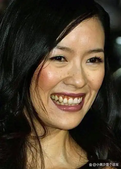 而且脸上还会有这么多的斑斑点点,作为一个大明星,平时也没有注重于