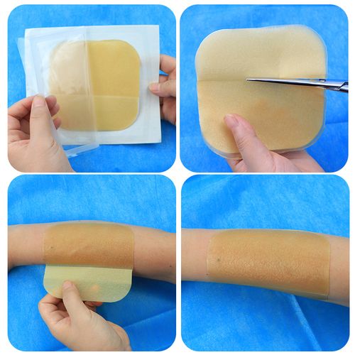 康维德敷料伤口尔非惠尔贴康痘痘187955胶体水胶伤口敷料