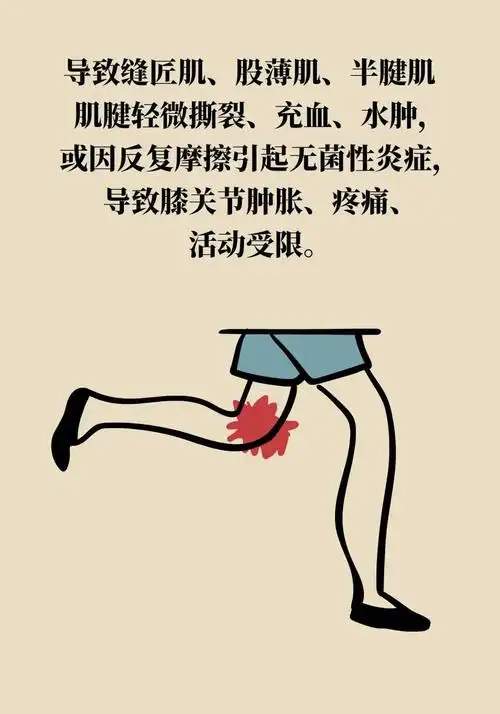 突然膝盖疼?