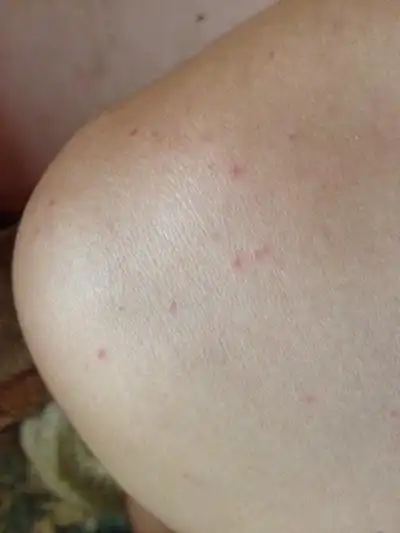 艾滋病红点图片 (51)