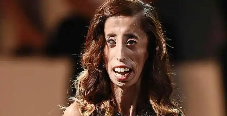 世界上最丑女人的主角,拥有着无数追求者,让人羡慕不已