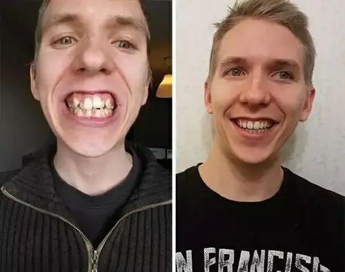 你一定要整牙,你一定要整牙,你一定要整牙,你一定要整牙