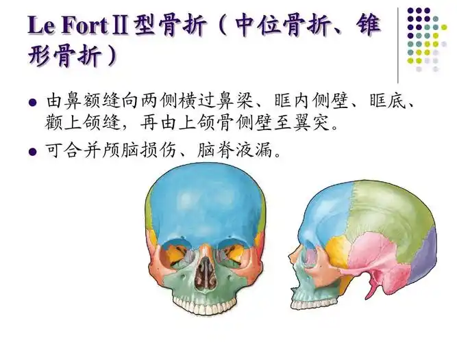 口腔颌面外科_颌骨骨折
