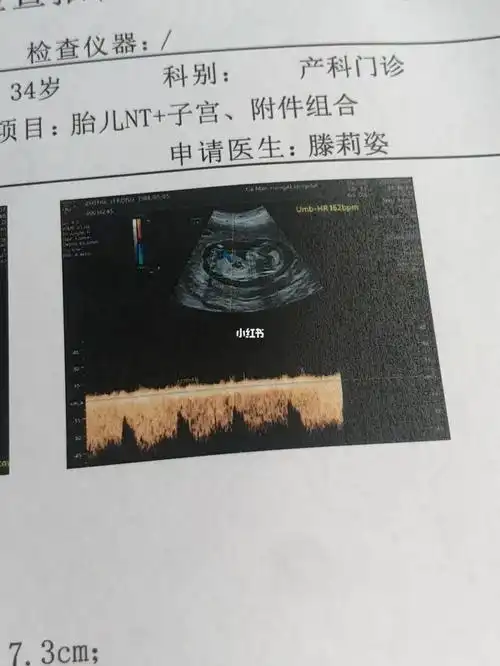 大神们懂得看男女吗纯属好奇