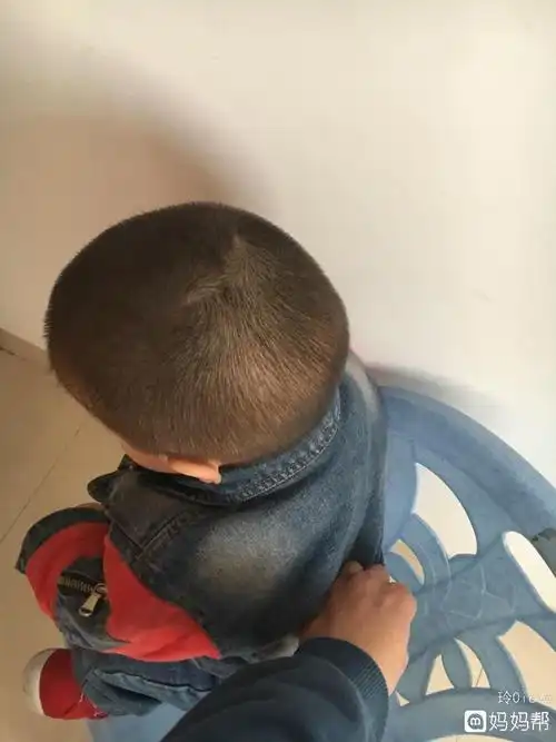 15个月这个头型是舟状头吗?头睡尖才有救 - 2017年4月出生帮 - 妈妈帮