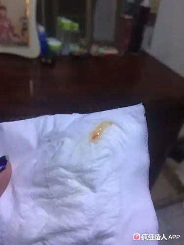 这个是受精卵着床失败流出来了吗